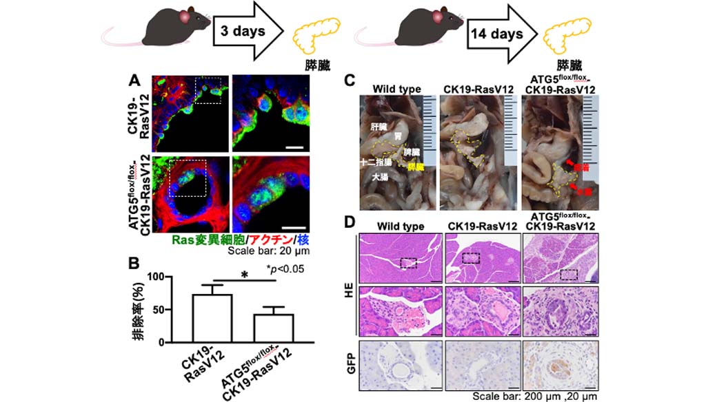 オートファジーががん細胞を排除することを発見、新たながん治療法開発に期待
~細胞競合によるがん細胞除去におけるオートファジーの役割を解明~