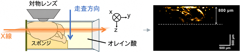 NIR-MAXWELLの観察原理と脳血管画像
